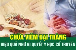 Chữa bệnh viêm đại tràng mãn tính cùng bác sĩ Tuyết Lan