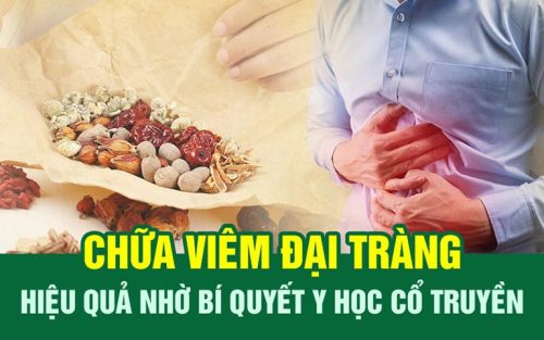 Chữa bệnh viêm đại tràng mãn tính cùng bác sĩ Tuyết Lan