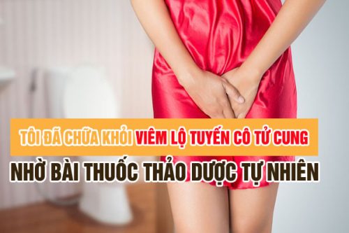 Chữa viêm lộ tuyến cổ tử cung