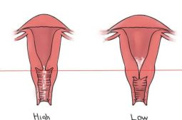 Cổ tử cung cao có ảnh hưởng gì? Thông tin cần biết