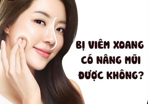 bị viêm xoang có nâng mũi được không