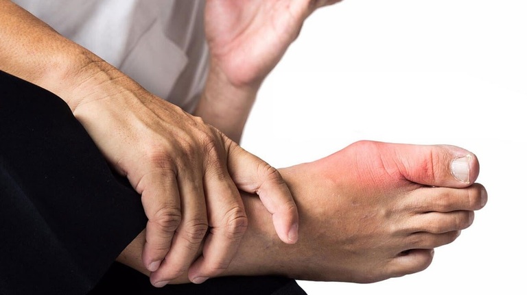 Cách phân biệt viêm khớp dạng thấp và gout 