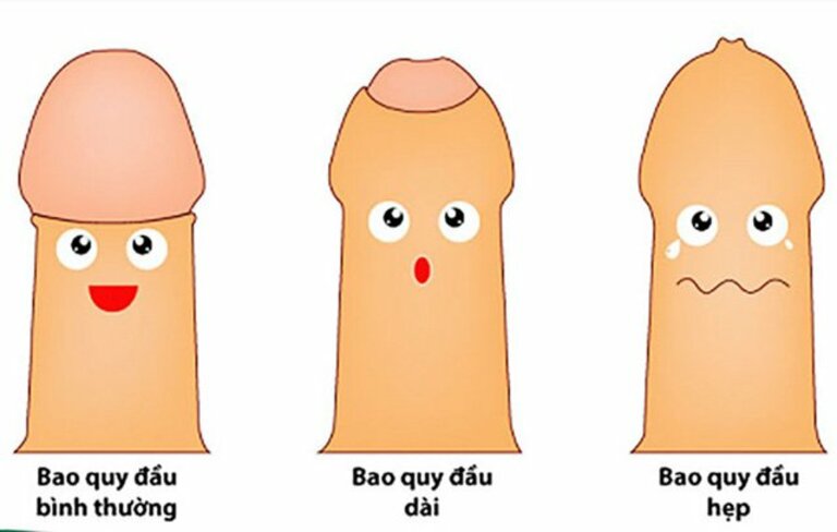 Vì sao bao quy đầu chưa lột?