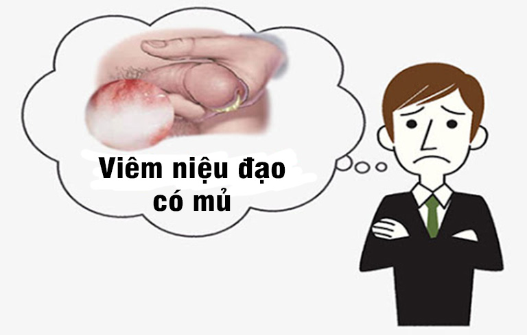 Viêm niệu đạo có mủ là gì? Nguyên nhân và triệu chứng