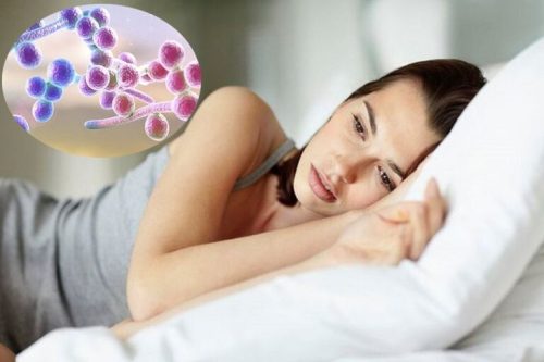 Nấm candida có lây không? Làm sao phòng ngừa?