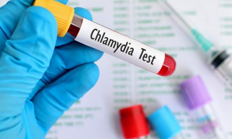 xét nghiệm Chlamydia