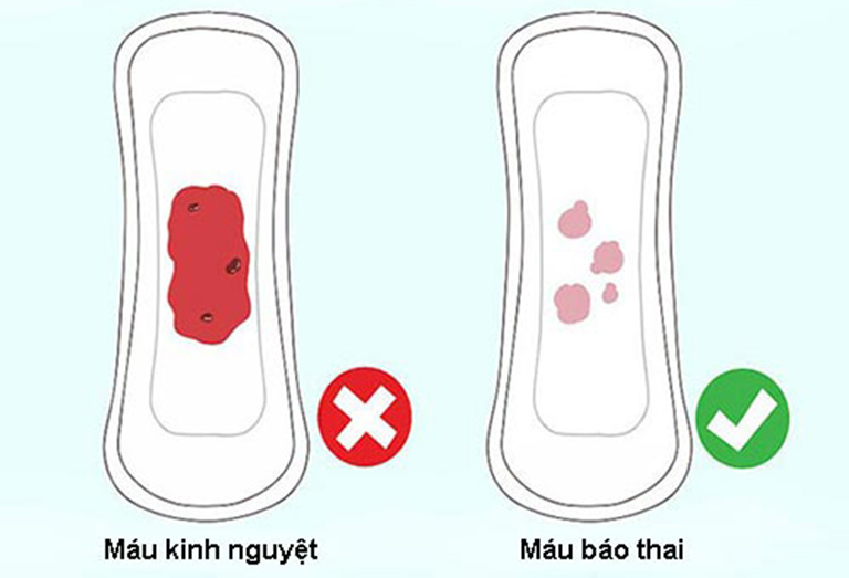 dấu hiệu thai kỳ