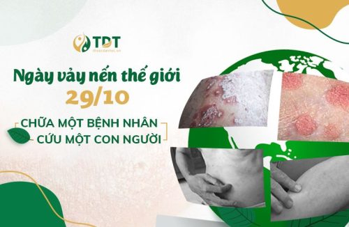 Ngày Vảy nến Thế giới 29 - 10