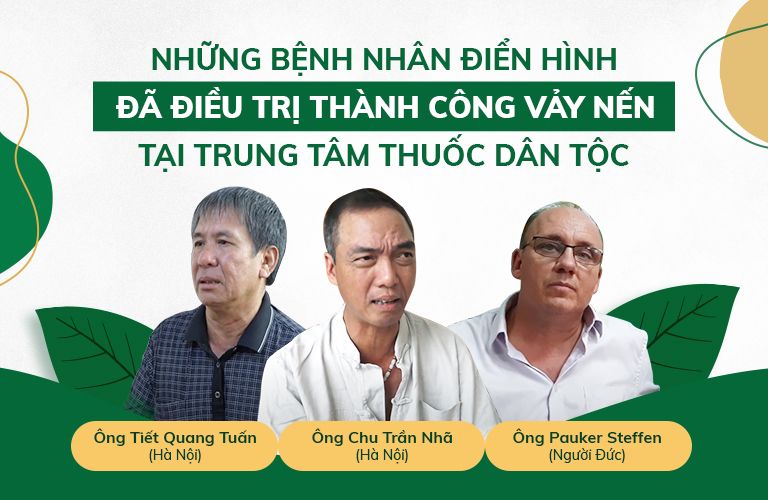 Bệnh nhân vảy nến tiêu biểu đã điều trị thành công vảy nến tại TT Thuốc dân tộc