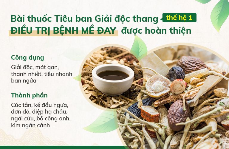 Bài thuốc Tiêu ban Giải độc thang thế hệ 1 được hoàn thiện