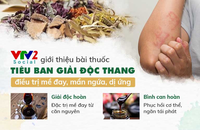 Công thức thuốc Tiêu ban Giải độc thang được VTV2 đưa tin