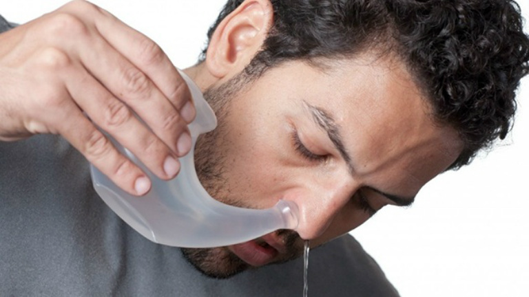 Rửa mũi chữa viêm xoang bao nhiêu lần/ngày?