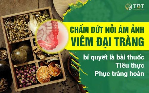 Tiêu thực Phục tràng hoàn có tốt không? [Chuyên gia, Bệnh nhân đánh giá]