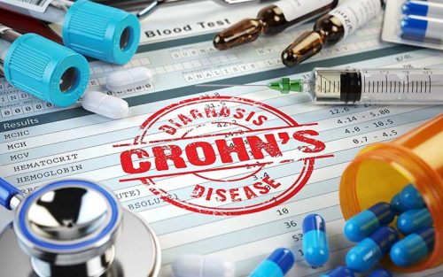 thuốc điều trị bệnh Crohn