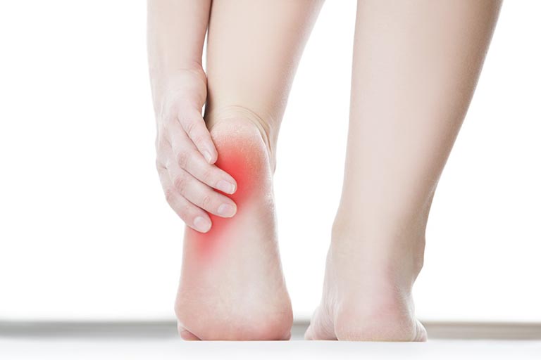 Đau gót chân là bệnh gì?