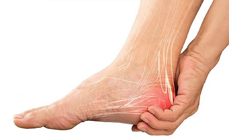 Các phương pháp chữa gai gót chân bằng đông y