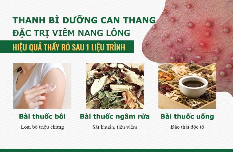 Bài thuốc chữa viêm nang lông hiệu quả và an toàn