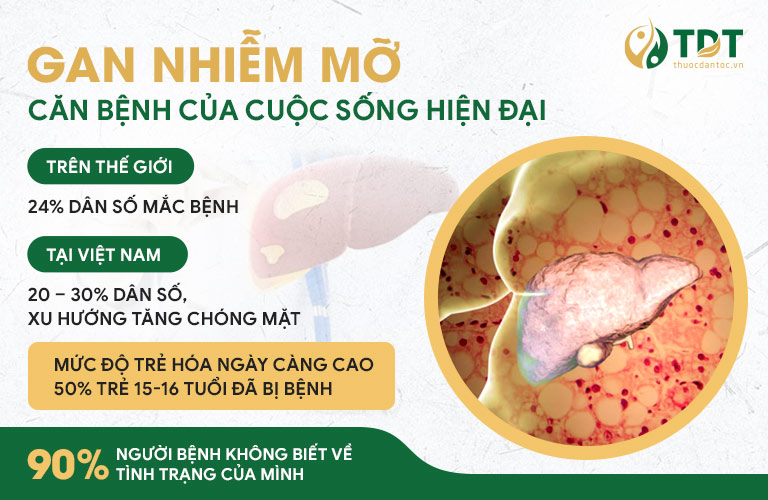 Gan nhiễm mỡ là bệnh lý nguy hiểm, cần điều trị càng sớm càng tốt