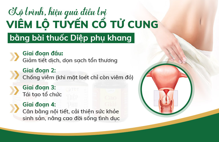 Bài thuốc Diệp Phụ Khang được ứng dụng theo lộ trình rõ ràng trong điều trị viêm lộ tuyến cổ tử cung