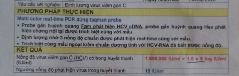 Xét nghiệm viêm gan C của anh S