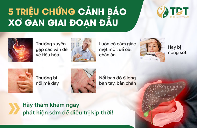 triệu chứng xơ gan