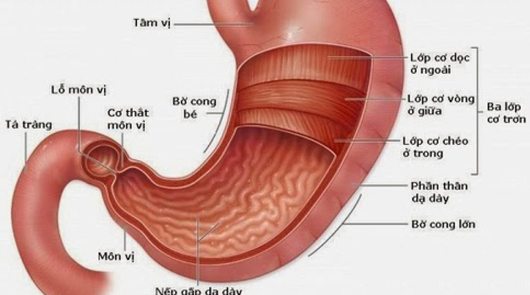 Viêm loét bờ cong nhỏ dạ dày