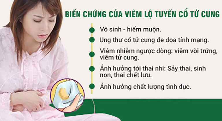 Một số biến chứng nguy hiểm của viêm lộ tuyến cổ tử cung