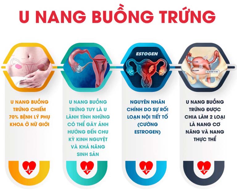 Một số thông tin cơ bản về khối u nang buồng trứng