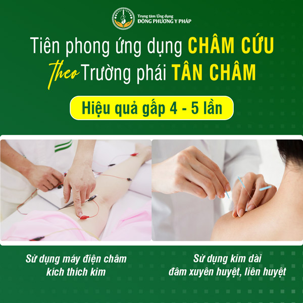 Đông Phương Y Pháp tiên phong ứng dụng châm cứu theo Trường phái Tân Châm)