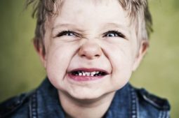 Áp Xe Răng Ở Trẻ Em: Biểu Hiện và Phương Pháp Điều Trị