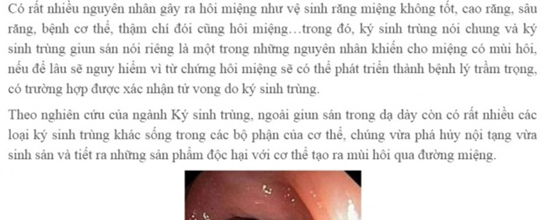 Ký sinh trùng gây hôi miệng