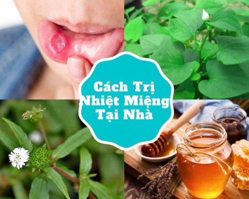 Cách trị nhiệt miệng tại nhà