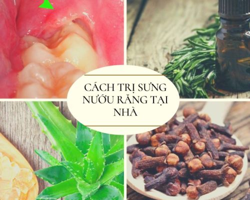 Có nhiều cách trị sưng nướu răng tại nhà theo mẹo dân gian