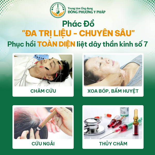 Bên cạnh cấy chỉ, trung tâm còn kết hợp thêm nhiều kỹ thuật vật lý trị liệu chữa liệt dây thần kinh số 7 khác