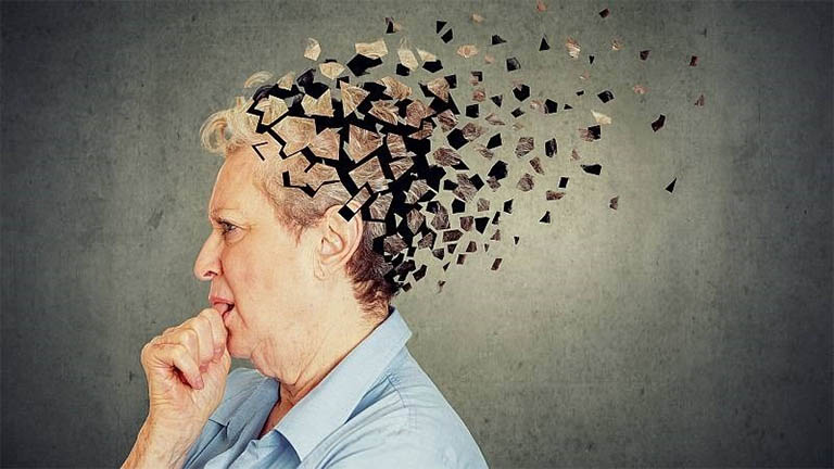 Hội chứng Alzheimer
