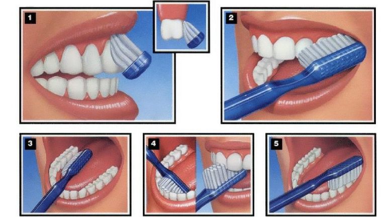 Chải răng đúng cách để bảo vệ sức khỏe răng miệng