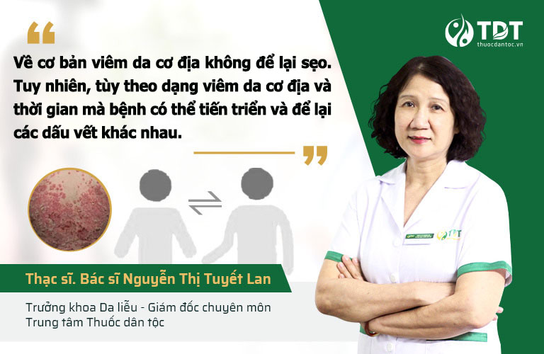 Nhận định của bác sĩ Tuyết Lan về khả năng để lại sẹo của bệnh viêm da cơ địa