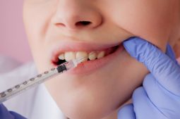 Lấy tủy răng có chích thuốc tê không là thắc mắc chung của nhiều người
