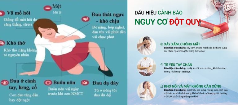 Sự khác nhau về triệu chứng giữa nhồi máu cơ tim và đột quỵ