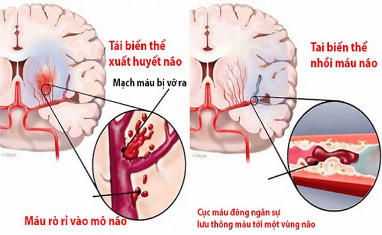 Tùy vào tình trạng bệnh mà bác sĩ sẽ chỉ định phương pháp chẩn đoán, kiểm tra phù hợp