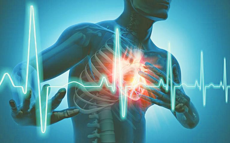 Rối loạn nhịp tim rất dễ gây trụy tim, nhồi máu cơ tim