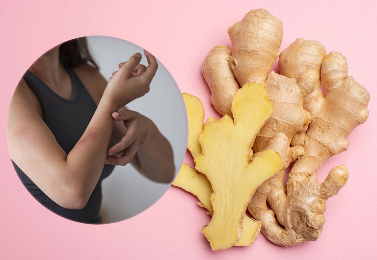 Hợp chất gingerol trong gừng có khả năng kháng viêm, chống oxy hóa mạnh