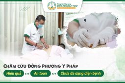 Châm cứu Đông Phương Y Pháp – Hiệu quả, An toàn, Chữa đa dạng diện bệnh