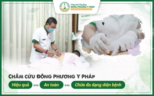 Châm cứu Đông Phương Y Pháp – Hiệu quả, An toàn, Chữa đa dạng diện bệnh