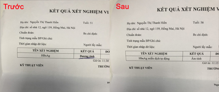 Kết quả xét nghiệm của bệnh nhân viêm gan B trước và sau khi điều trị bằng bài thuốc Bảo nam Ích can thang