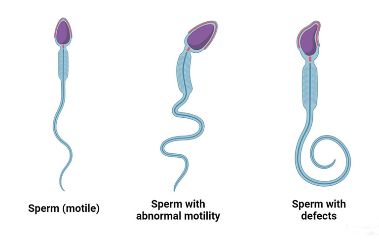 Tinh trùng khỏe mạnh là những con tinh trùng không bị dị dạng