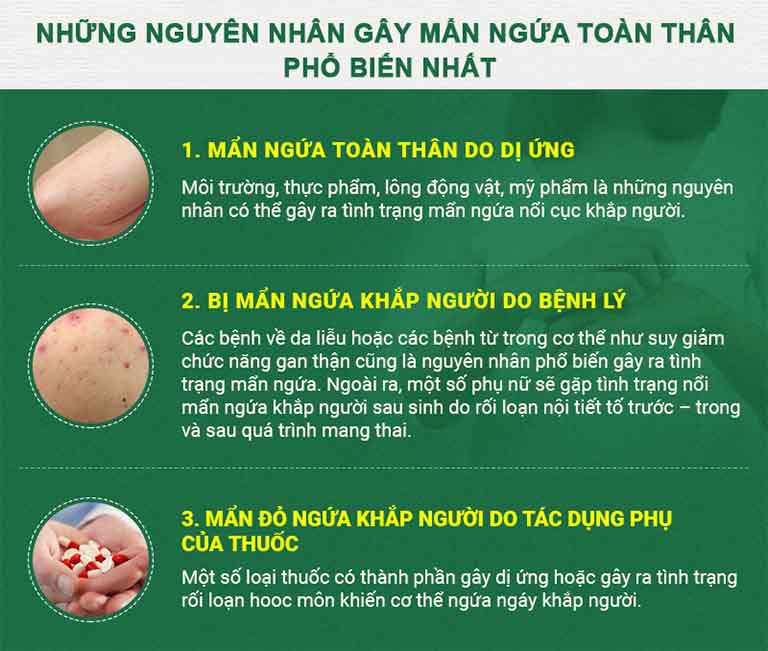 Nguyên nhân gây mẩn ngứa toàn thân