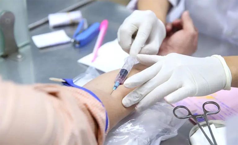 Chỉ số PCT 0.03 ng/ml có thấp quá không? Phản ánh điều gì? - Thuốc Dân Tộc