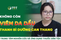 Chữa Thành Công Viêm Da Dầu Ở Mặt Giúp Cô Sinh Viên Trẻ Lấy Lại Sự Tự Tin