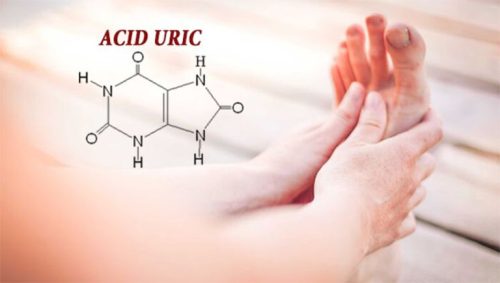 Chỉ số axit uric 480 có phải ngưỡng an toàn không?